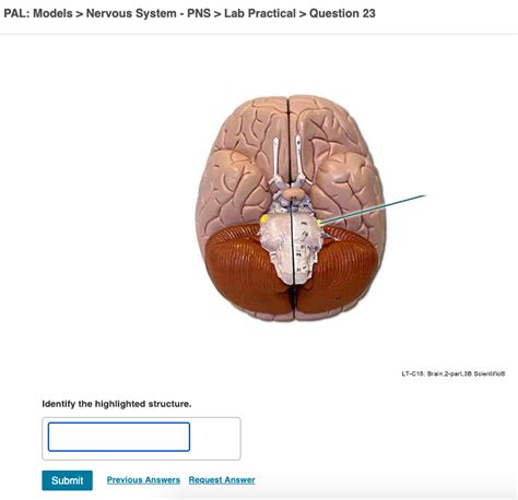 Solved Pal Models Nervous System Pns Lab Practical Chegg