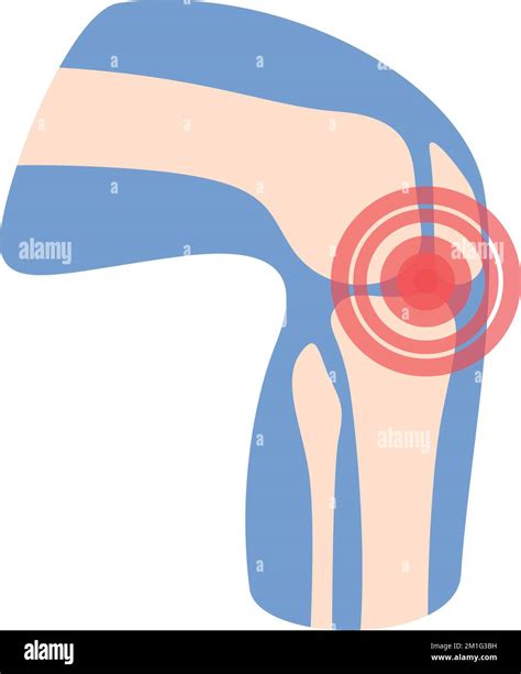 Icono De Dolor De Rodilla Vector De Dibujos Animados Artritis