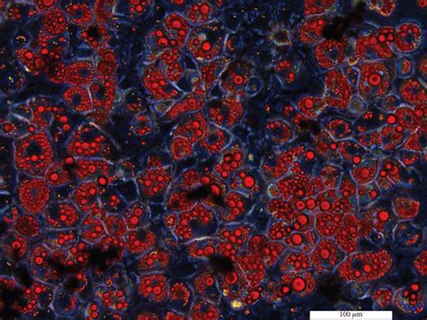 Differentiated And Mature 3T3 L1 Adipocytes Oil Red O Staining