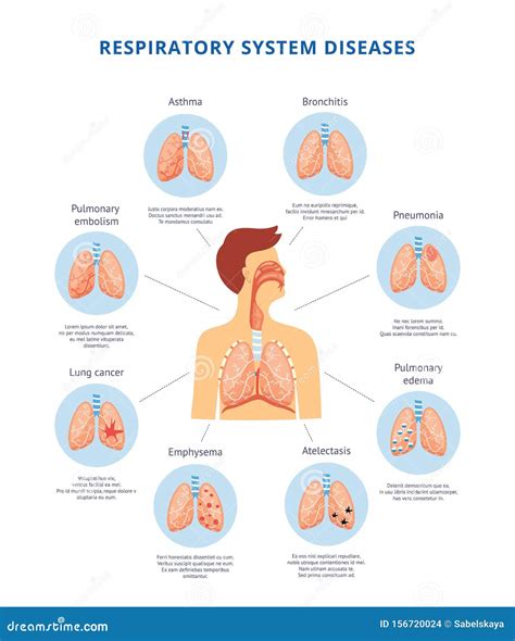 Diagrama Informativo De Ilustraciones Vectoriales De Enfermedades Del