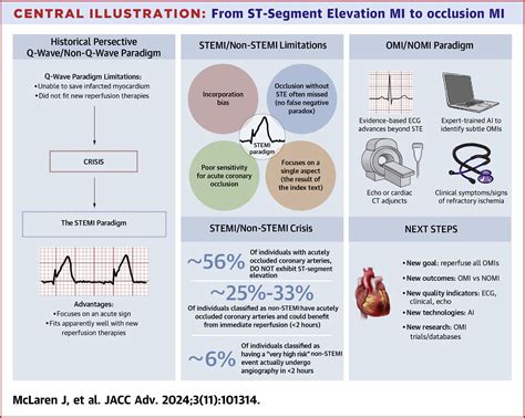 From St Segment Elevation Mi To Occlusion Mi The New Paradigm Shift In