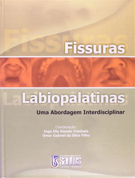 Fissuras Labiopalatinas Uma Abordagem Interdisciplinar PDF Inge Elly