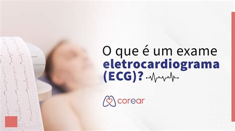 Eletrocardiograma O Que É - O que é um exame eletrocardiograma (ECG)?