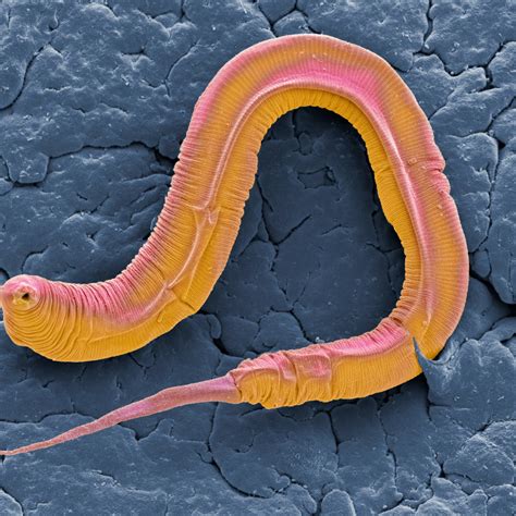 Weird Tapeworm Symptoms at David Daigle blog