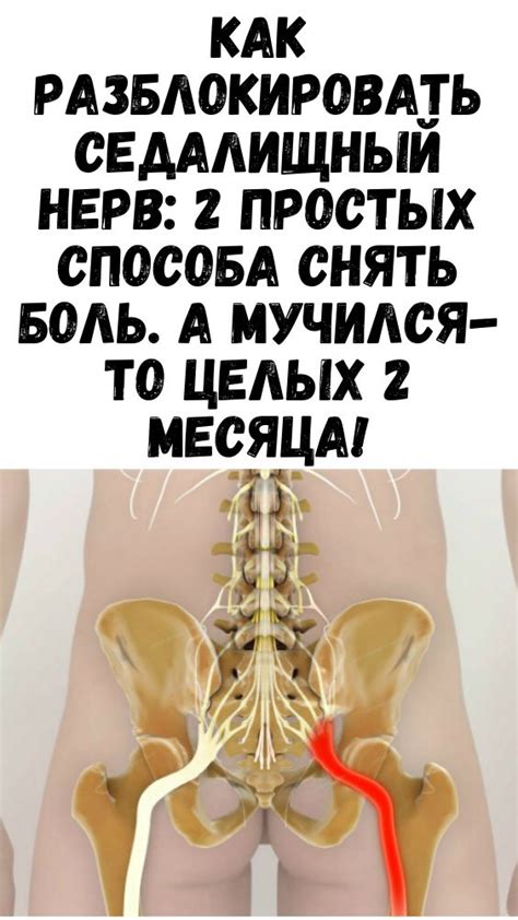 Разное | Седалищный нерв, Лечение спины, Лечение