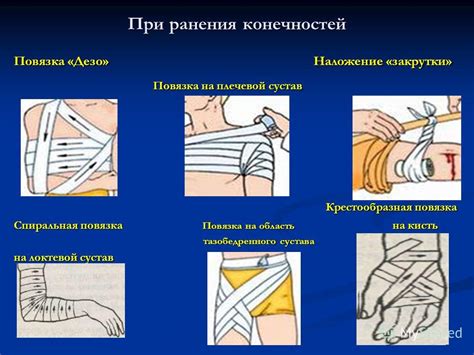Презентация на тему: "Тема урока : РАНЫ Часть-I. х арактеристика ран ...