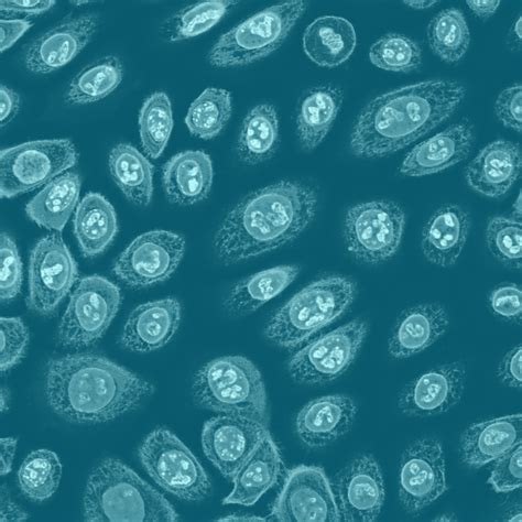 Normal Human Epidermal Keratinocytes : Get Quote, RFQ, Price or Buy