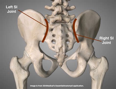 Understanding Sacroiliac Joint Dysfunction And Strate - vrogue.co
