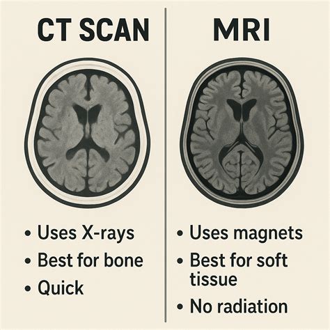 radiographicgyan difference  ct scan  mri