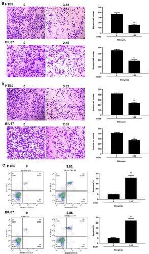 Full Article Magnesium Isoglycyrrhizinate Suppresses Bladder Cancer