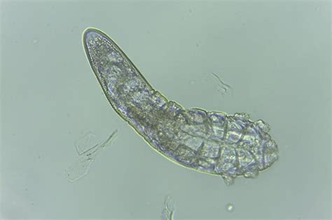 Face Mites Have Been Evolving Alongside Humans From The Start