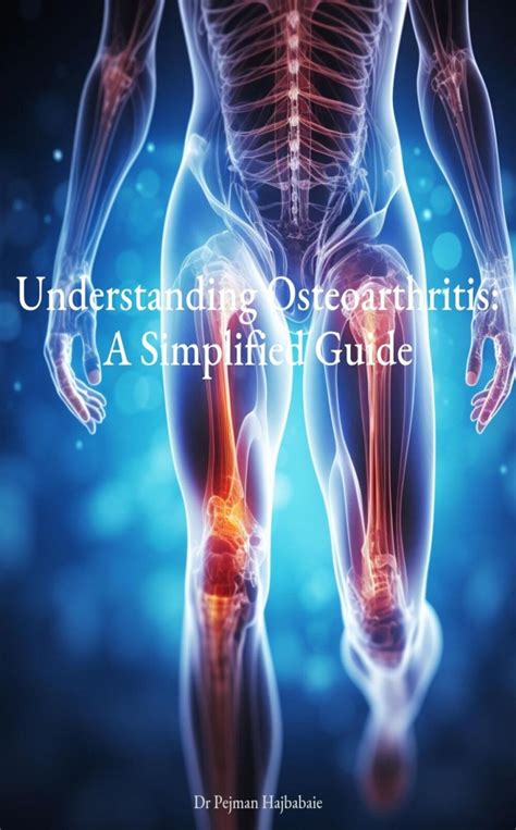 Understanding Osteoarthritis: A Simplified Guide eBook by Pejman