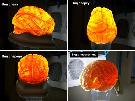 Фантом — полезный помощник в медицине