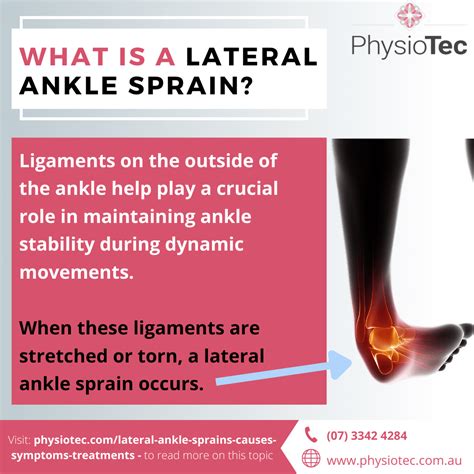lateral ankle sprains  dancers  symptoms treatments