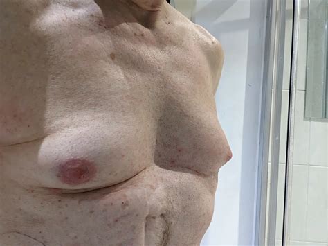 Moobs Nude Pics XHamster