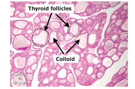 Lec 3 Thyroid Gland Flashcards Quizlet