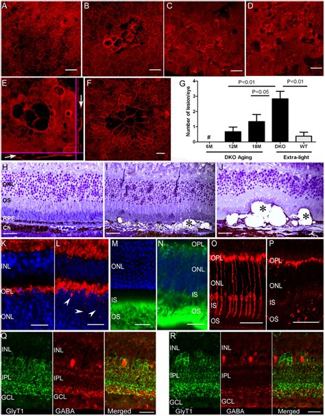 Retinal Pigment Epithelium Rpe Damage Photoreceptor Degeneration And