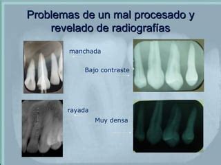 Interpretaci N De Radiograf As Ppt Descarga Gratuita