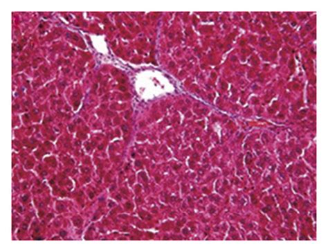 Ce Ameliorates Hepatic Fibrosis In Rats With Ccl Induced Liver Damage