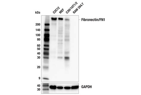 Fibronectin FN1 E7F5X Rabbit MAb Cell Signaling Technology