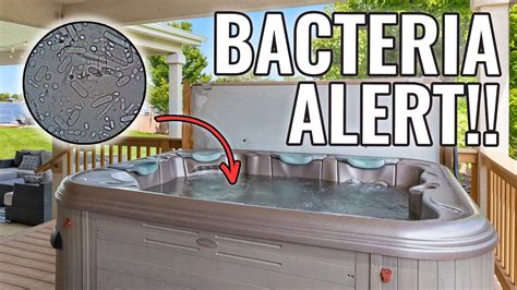 Bacteria Alert The Unseen Threats Lurking In Your Hot Tub Youtube