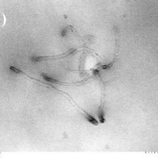 a TEM (low magnification) b TEM (high magnification) c SEM of ultrathin ...