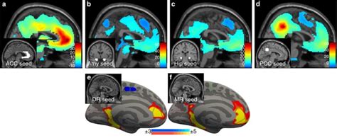 Pharmacologically Induced Sex Hormone Fluctuation Effects On Resting State Functional