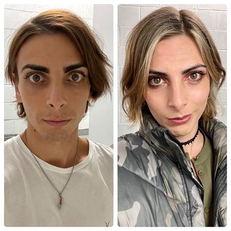 1 Month Hrt Vs 9 Months R Transtimelines