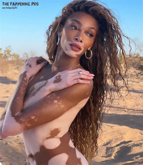 Winnie Harlow Naked For Women S Health Photos The Fappening