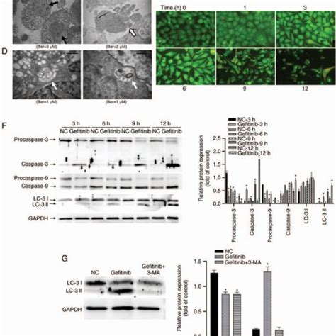 Gefitinib Treatment Can Induce Apoptosis And Autophagy In Cscc Cells