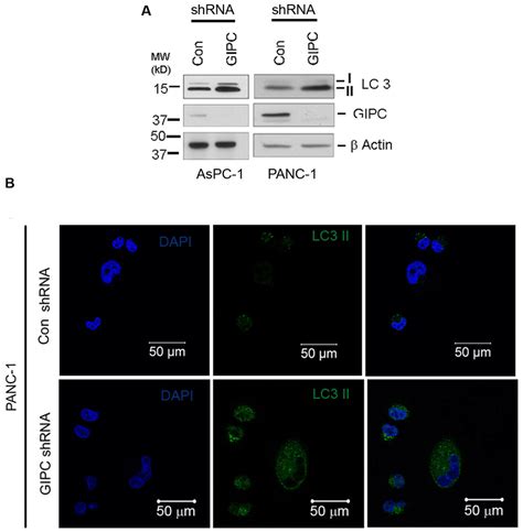 Gipc Induce Autophagy In The Pancreatic Cancer Cells A Aspc And