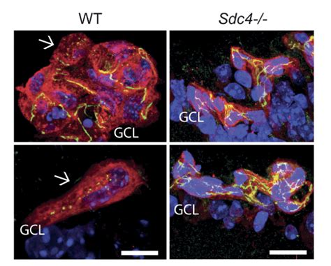 Reduced Ve Cadherin Internalization In Sdc Retinas After Oir Two