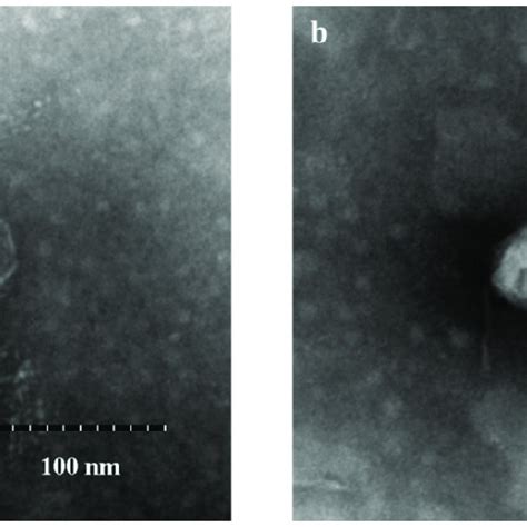 Morphology Of Phage Vb Vpap De Observed Using Transmission Electron