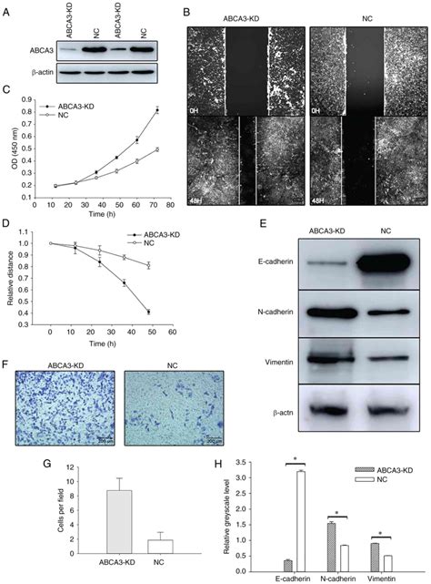 ABCA3 A Tumor Suppressor Gene Inhibits The Proliferation Migration