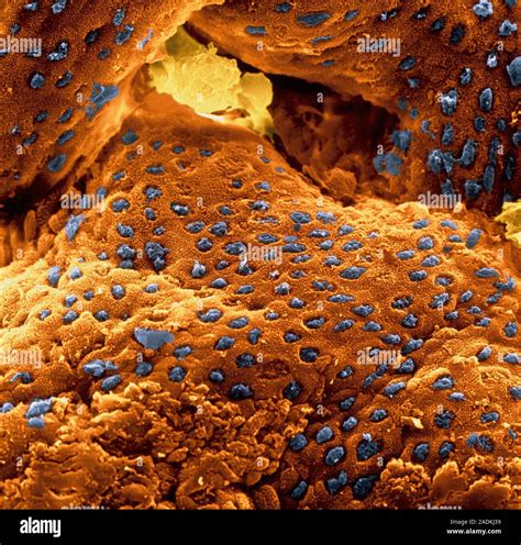 Colon Surface Coloured Scanning Electron Micro Graph SEM Of The