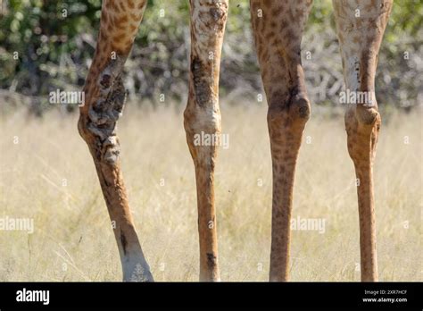 Some Giraffe In Ruaha National Park Exhibit Severe Lesions On Their