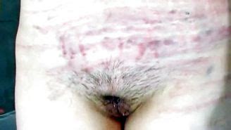 BdSm 1 Bondage Spanking Slapping Whipping Torture Porn Pictures XXX Photos Sex Images