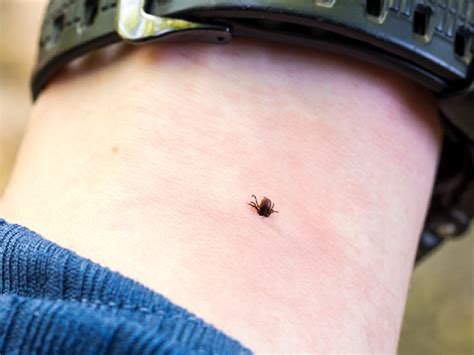 Tick Bites On Humans Moliautomation