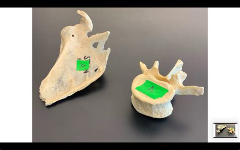 Solved Victim A Activity I Sex Determination From Pelvic Morphology Course Hero