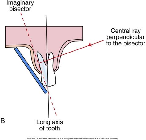 Ch 41 Intraoral Imaging Flashcards Quizlet