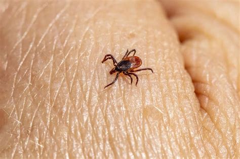 Piqûre De Tique Comment éviter La Maladie De Lyme