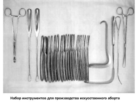 Прерывание беременности - online presentation