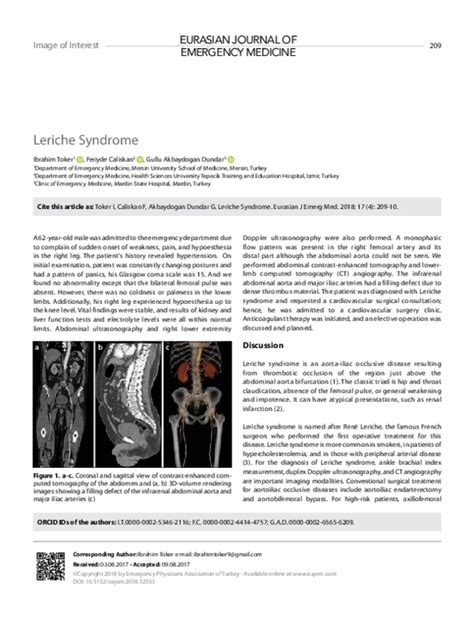 (PDF) Leriche Syndrome