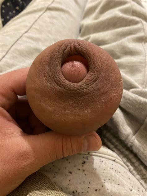 Extreme Stretching Foreskin 8 Nude Pics XHamster