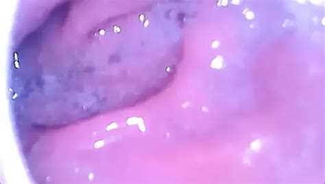 Anal Inside Camera XHamster