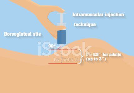 Intramuscular Injection Technique Vector Illustration. Angle Of ...