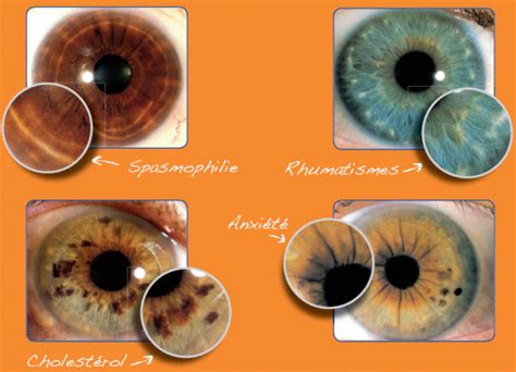 Main Iris Markings Rings Artofit