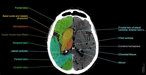 Anatomy Of The Brain And Face Labeled Ct E Anatomy