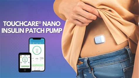 Révolutionner la gestion du diabète avec la Nano pompe à insuline ...