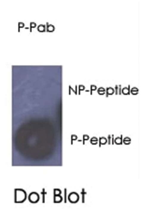 Anti Rb1 Antibody 400ul